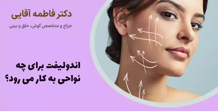 اندولیفت برای چه نواحی به کار می رود؟