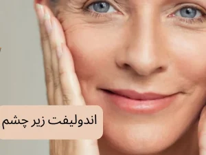 اندولیفت زیر چشم