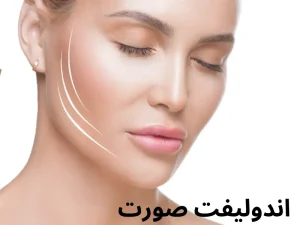 اندولیفت صورت