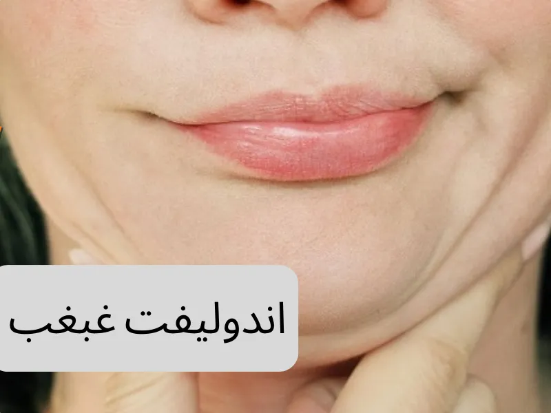 اندولیفت غبغب