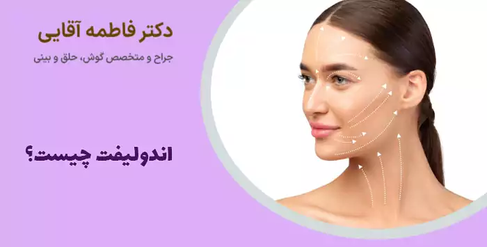 اندولیفت چیست؟