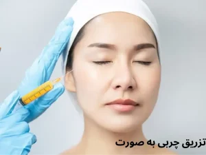 تزریق چربی به صورت