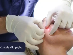 عوارض اندولیفت