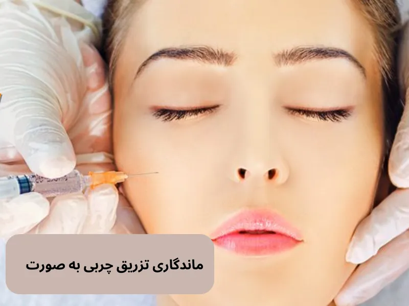 ماندگاری تزریق چربی به صورت