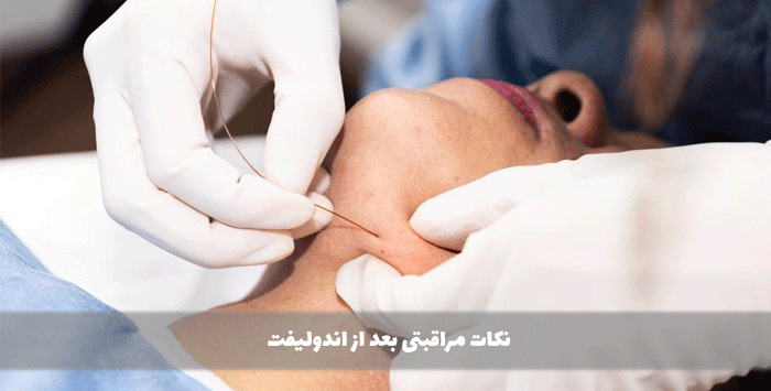 نکات مراقبتی بعد از اندولیفت
