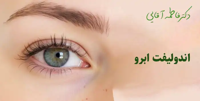 اندولیفت ابرو