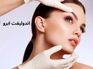 اندولیفت ابرو