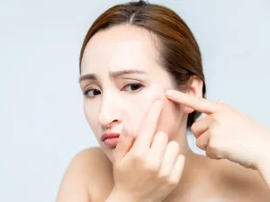 اندولیفت برای جای جوش