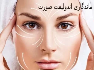 ماندگاری اندولیفت صورت