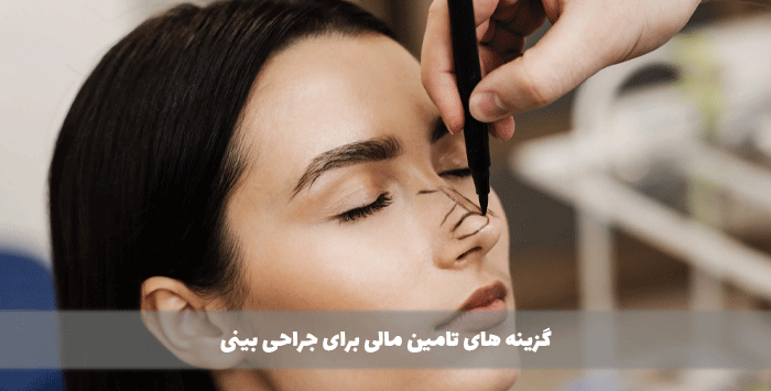 گزینه های تامین مالی برای جراحی بینی