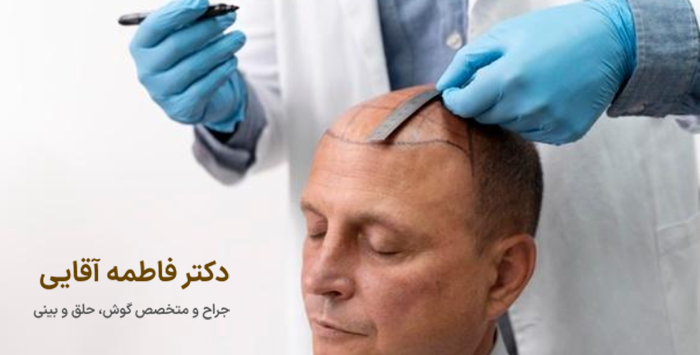 مزایای کاشت مو چیست؟
