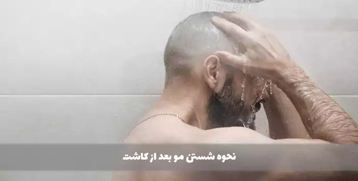 نحوه شستن مو بعد از کاشت
