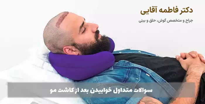 سوالات متداول خوابیدن بعد از کاشت مو