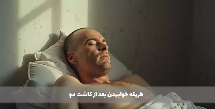 طریقه خوابیدن بعد از کاشت مو