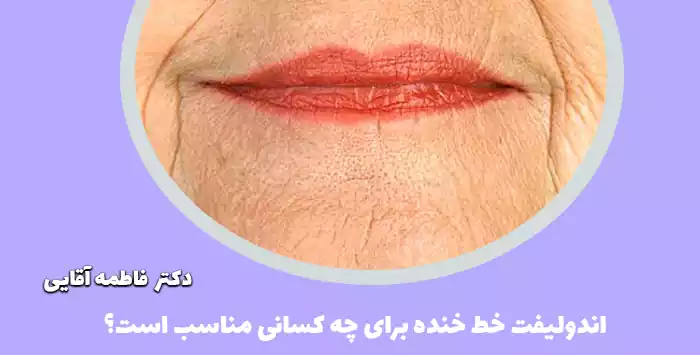 اندولیفت خط خنده برای چه کسانی مناسب است؟