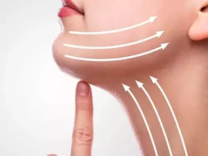 بهترین سن برای اندولیفت