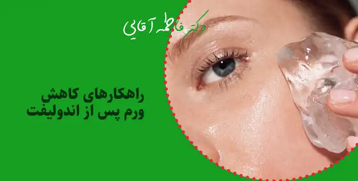راهکارهای کاهش ورم پس از اندولیفت