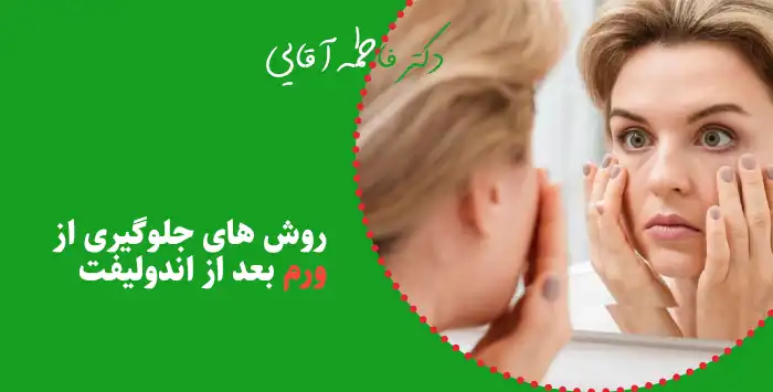 روش های جلوگیری از ورم بعد از اندولیفت