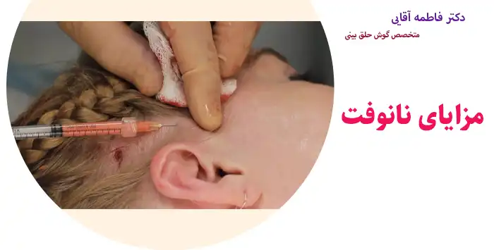 مزایای نانوفت