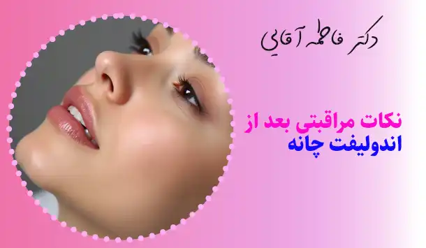نکات مراقبتی بعد از لیزر اندولیفت چانه