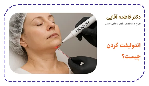 اندولیفت گردن چیست؟
