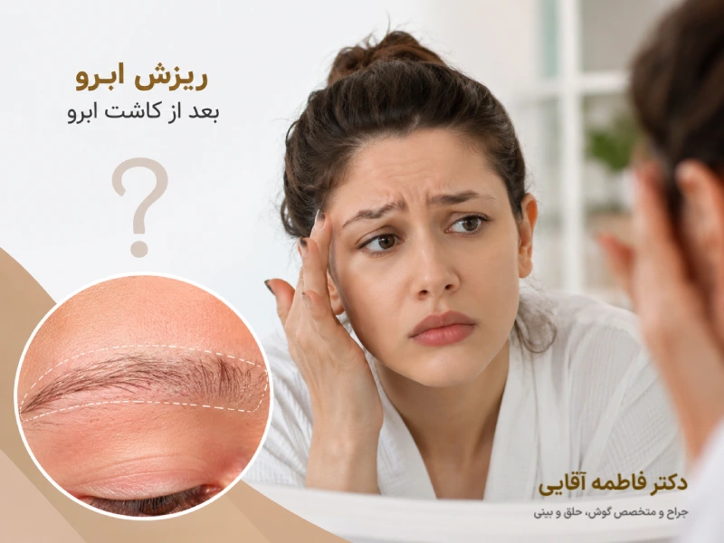 ریزش ابرو بعد از کاشت ابرو