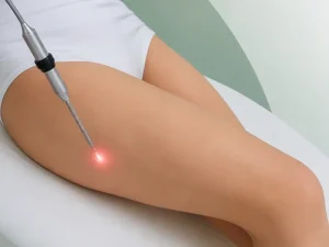 اندولیفت ران چگونه انجام میشود؟ مزایا به همراه نتایج آن